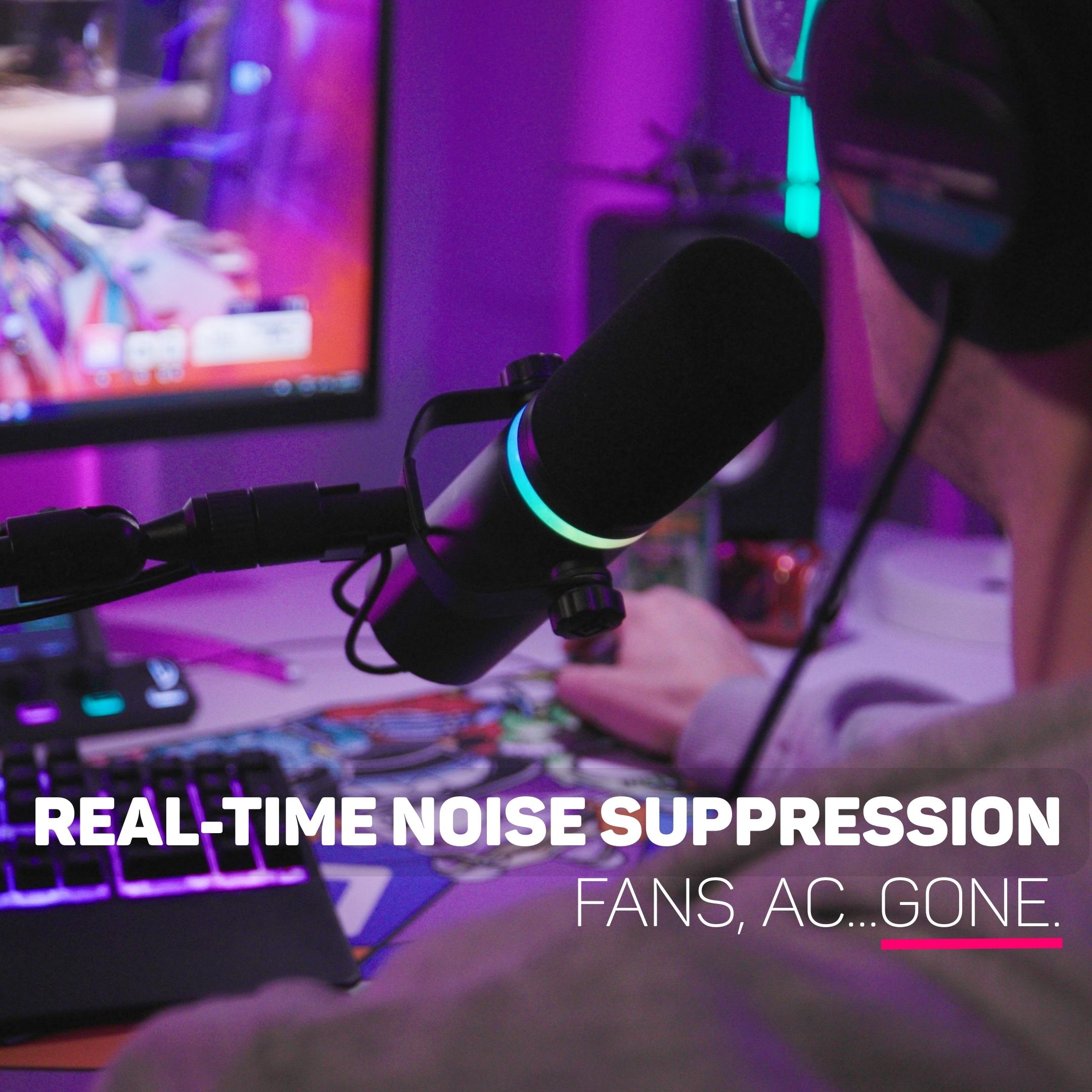 USB Broadcast Dynamic Mic for Streaming, Gaming, and Podcasting